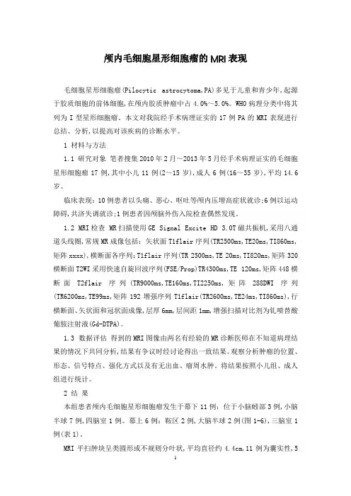 颅内毛细胞星形细胞瘤的MRI表现