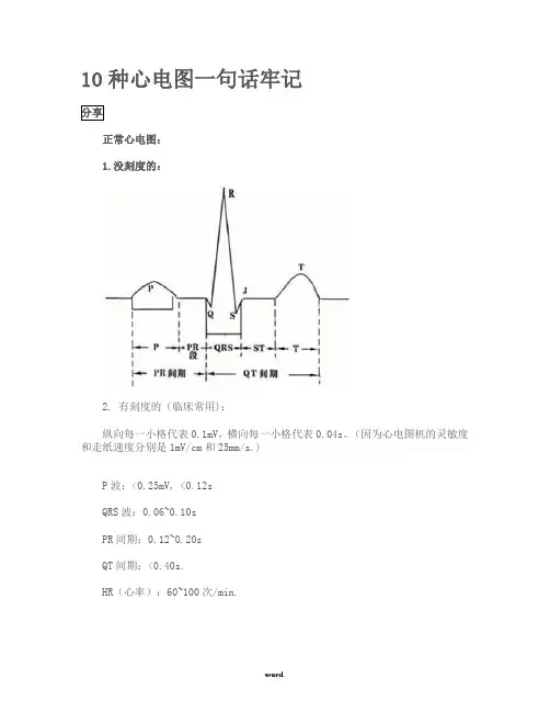 心电图口诀