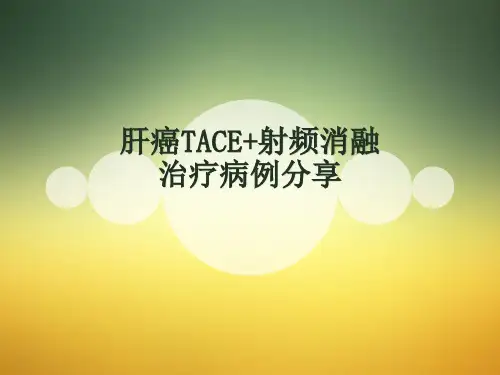 肝癌TACE十射频消融病例分享
