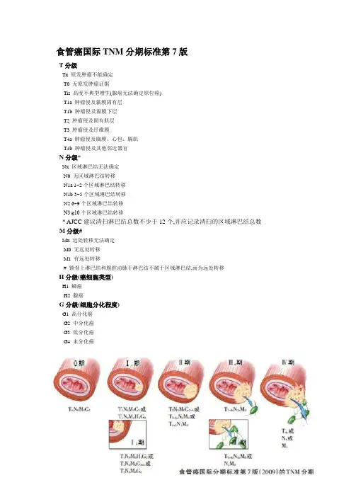 食管癌国际TNM分期标准第7版