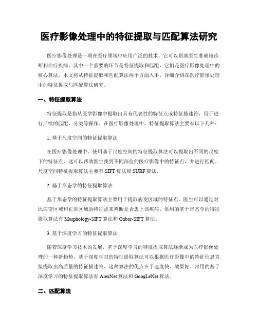 医疗影像处理中的特征提取与匹配算法研究