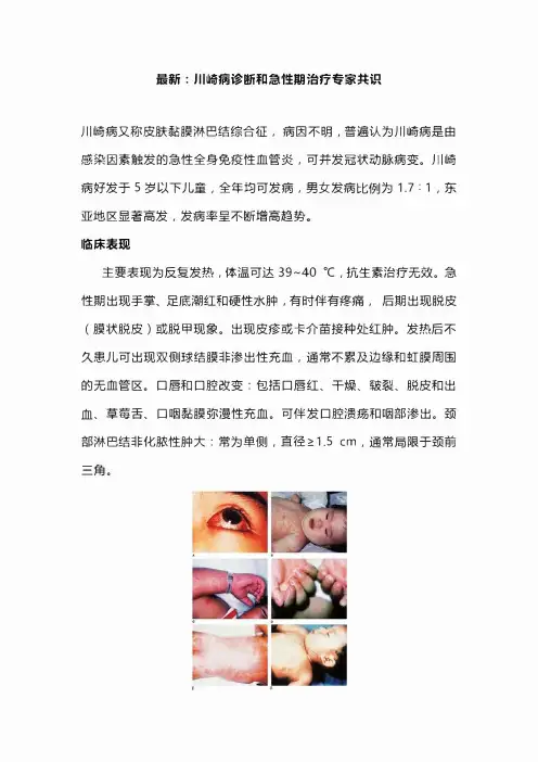 最新：川崎病诊断和急性期治疗专家共识