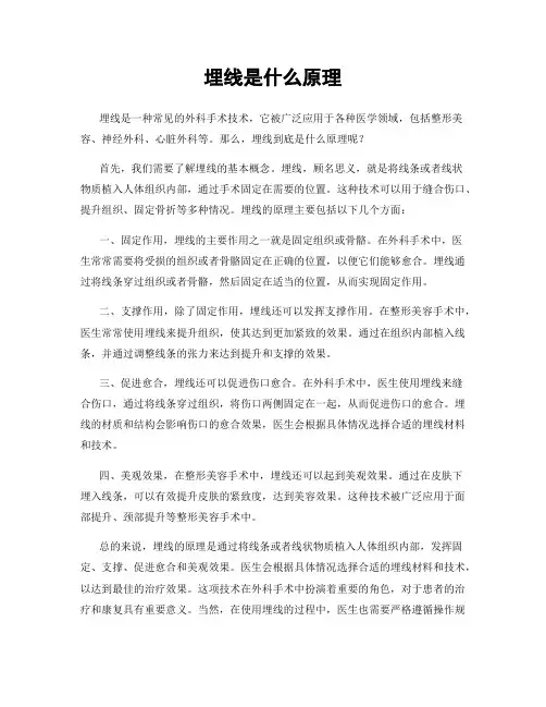 埋线是什么原理