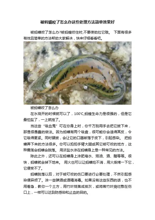 被蚂蟥咬了怎么办这些处理方法简单效果好