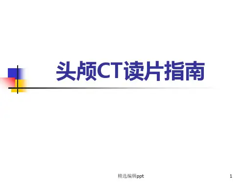 头颅CT最全读片ppt课件