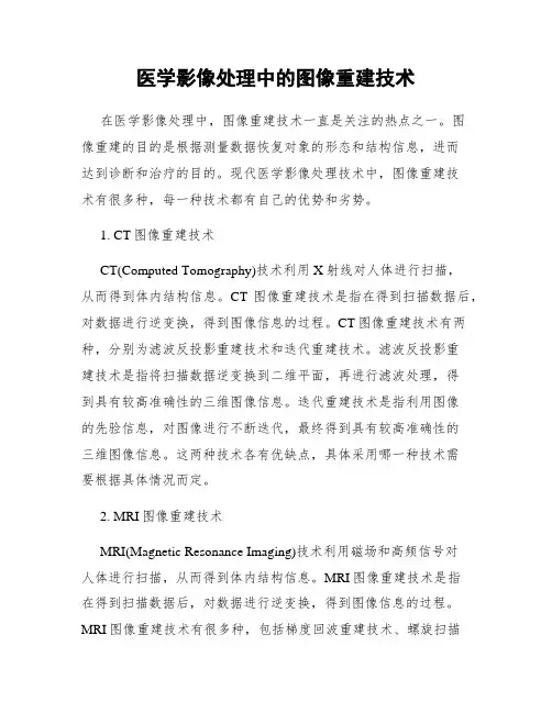 医学影像处理中的图像重建技术
