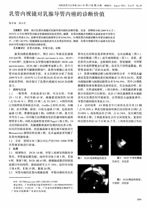 乳管内视镜对乳腺导管内癌的诊断价值