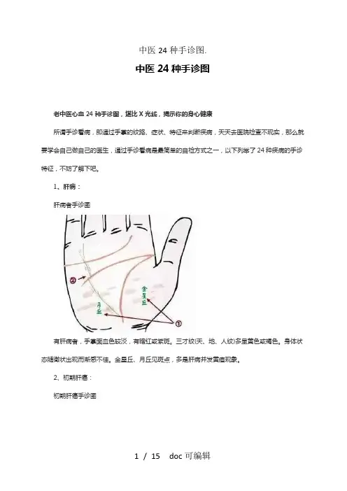 中医24种手诊图甄选.