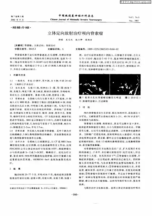 立体定向放射治疗颅内脊索瘤