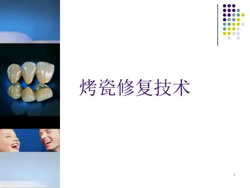 包埋铸造技术课件