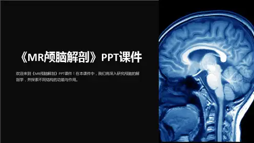 《MR颅脑解剖》课件