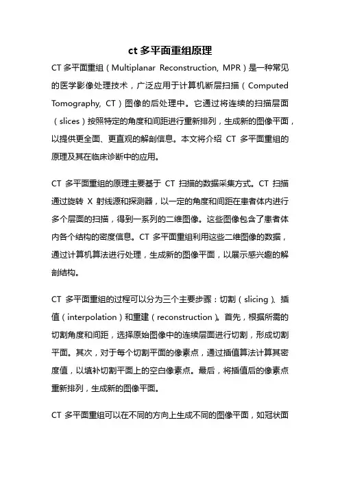 ct多平面重组原理