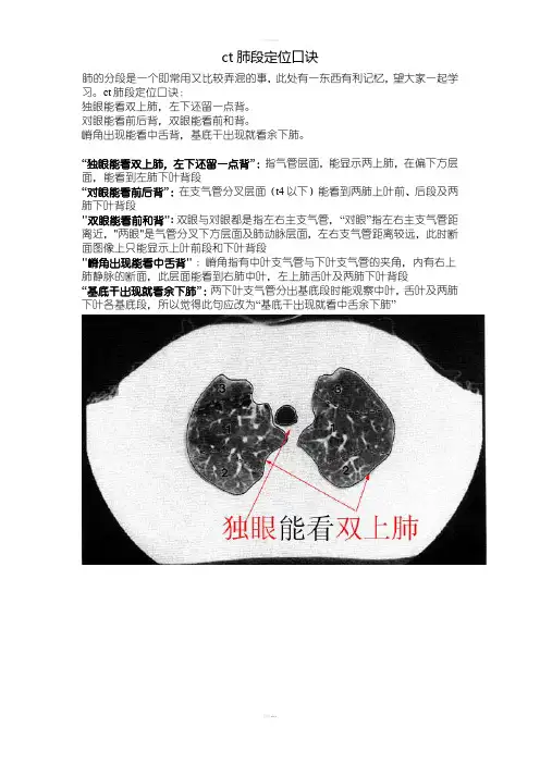 CT肺的分叶分段