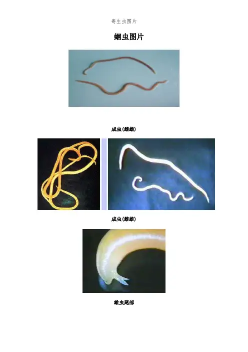 寄生虫图片