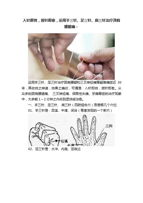 入针即效，拨针即愈，运用手三针、足三针、肩三针治疗颈肩腰腿痛～