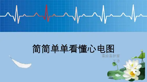 教你看懂心电图