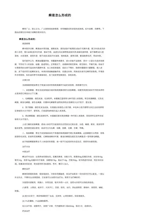癣是怎么形成的