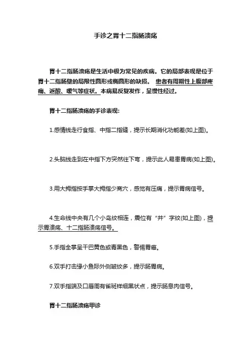 手诊之胃十二指肠溃疡