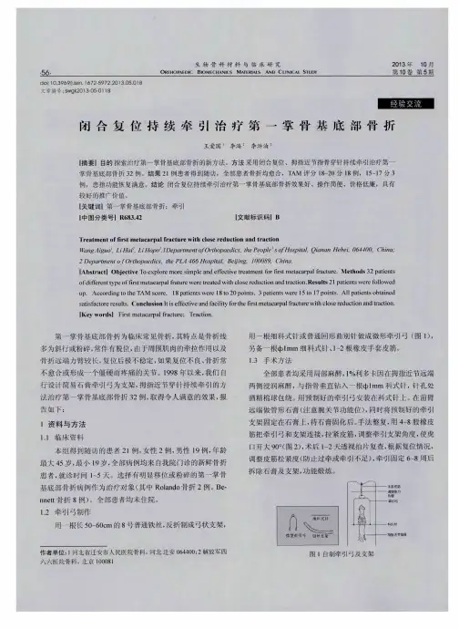 闭合复位持续牵引治疗第一掌骨基底部骨折