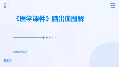 【医学课件】脑出血图解