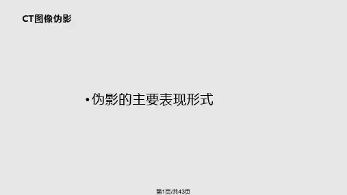 CT图像伪影PPT课件