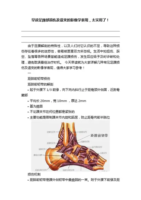早读足踝部损伤及退变的影像学表现，太实用了！