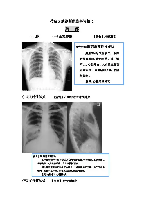 肺部诊断报告