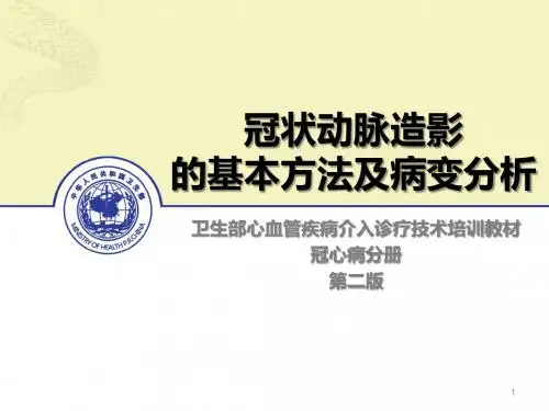 冠状动脉造影的基本方法及病变分析ppt课件