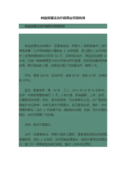 刺血拔罐法治疗肩周炎特别有效