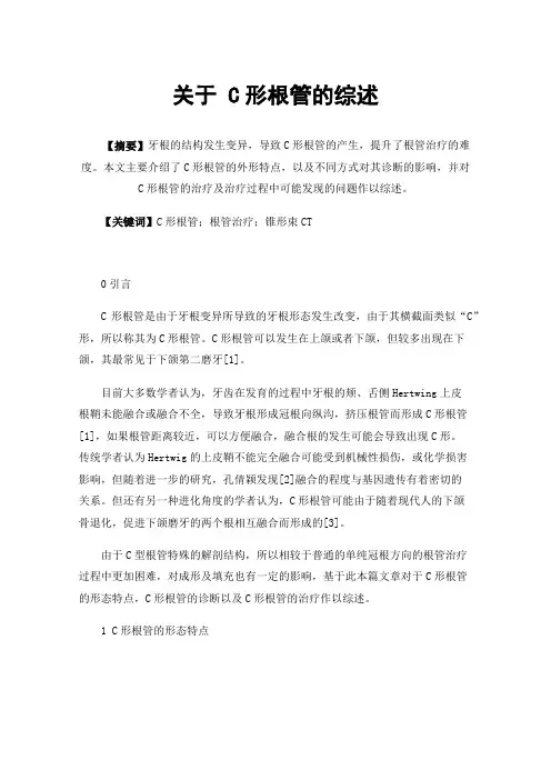 关于C形根管的综述
