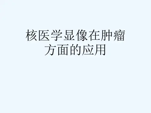 核医学显像在肿瘤方面的应用[可修改版ppt]
