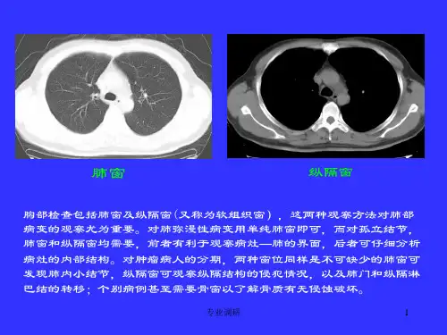胸部CT诊断资料严选材料
