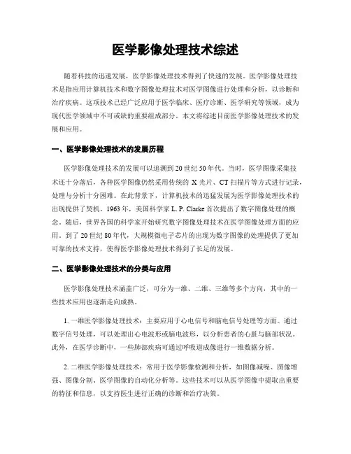 医学影像处理技术综述