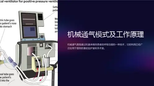 机械通气模式及工作原理