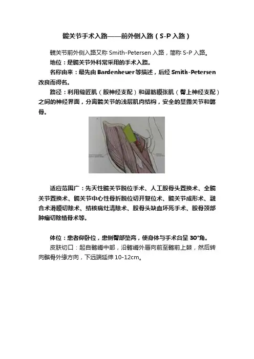 髋关节手术入路——前外侧入路（S-P入路）