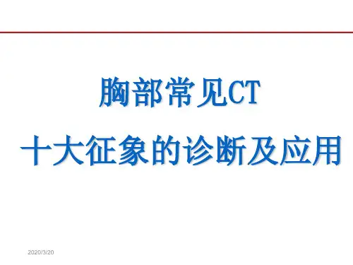 肺部CT十大征象诊断应用1