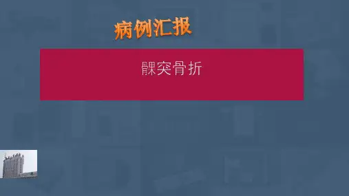 口腔病例汇报 ppt课件