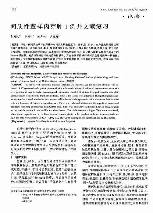 间质性蕈样肉芽肿1例并文献复习