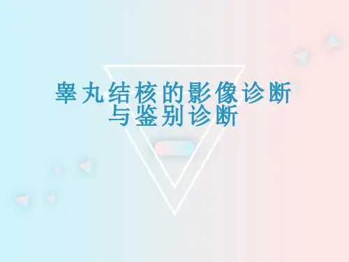 睾丸结核的影像诊断与鉴别诊断