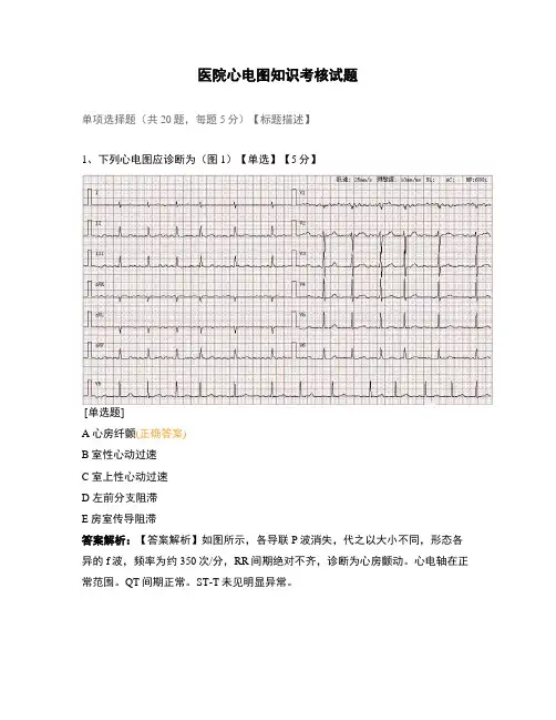 医院心电图知识考核试题