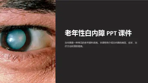 《老年性白内障》课件
