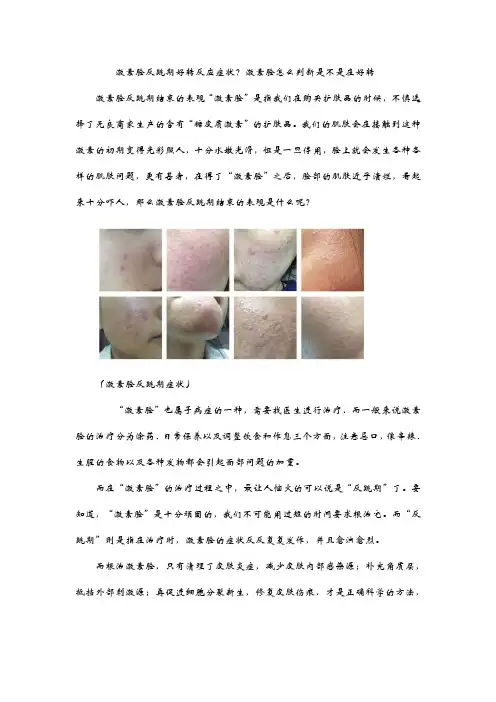 激素脸反跳期好转反应症状？激素脸怎么判断是不是在好转