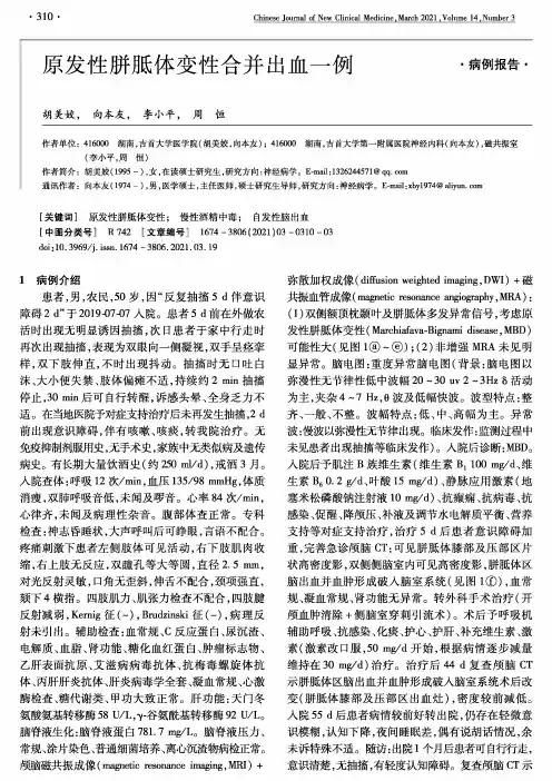 原发性胼胝体变性合并出血一例