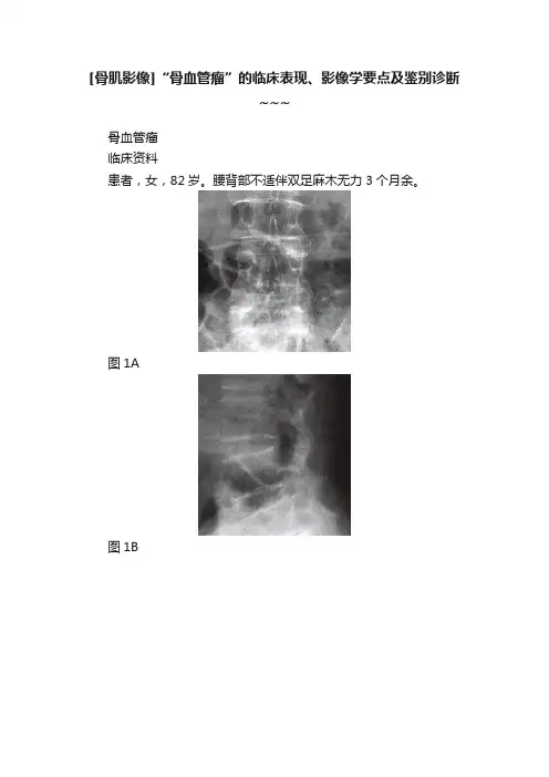 [骨肌影像]“骨血管瘤”的临床表现、影像学要点及鉴别诊断~~~