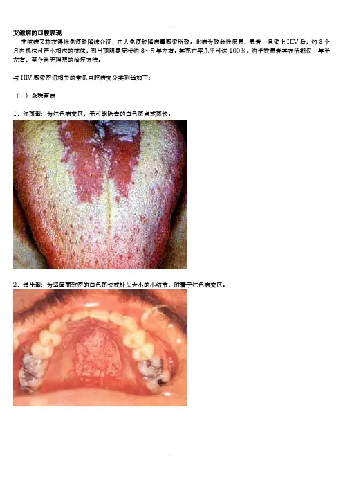 艾滋病的口腔表现图谱