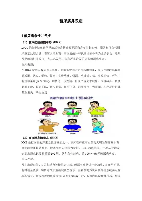 糖尿病并发症