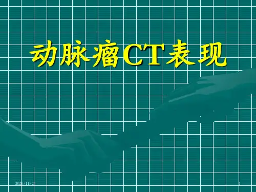 动脉瘤CT表现 ppt课件