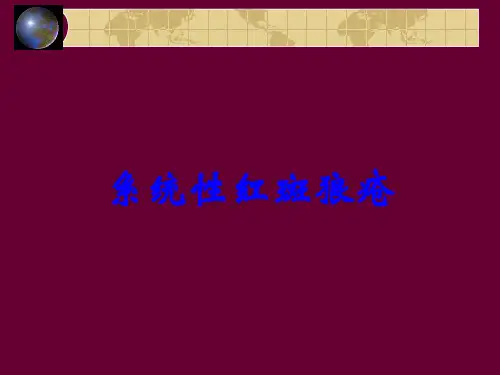 系统性红斑狼疮