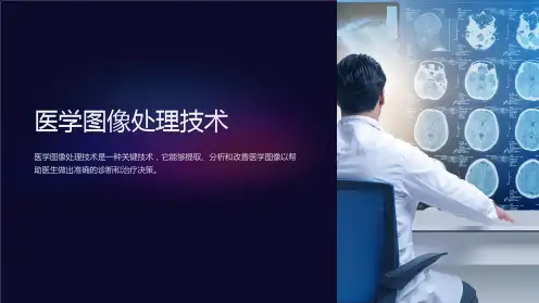 医学图像处理技术