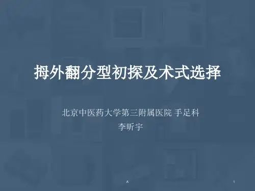 拇外翻(李昕宇)